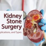 Kidney stone surgery procedures removal